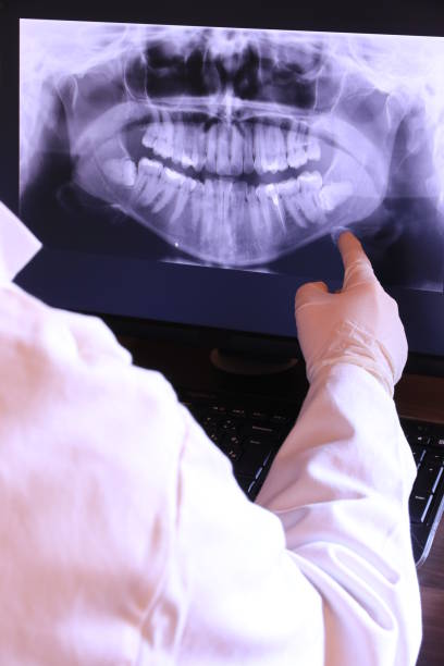 Best Emergency Denture Repair in Centre Hall, PA